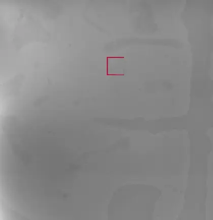 White Spots Detection